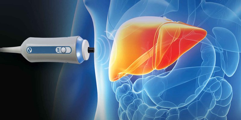 Fibroscan Services at OmegaEndo - Advanced Liver Diagnostics